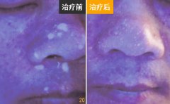 舟山最好的白癜风专科医院