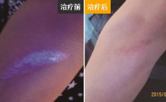 舟山最好的白癜风专科医院